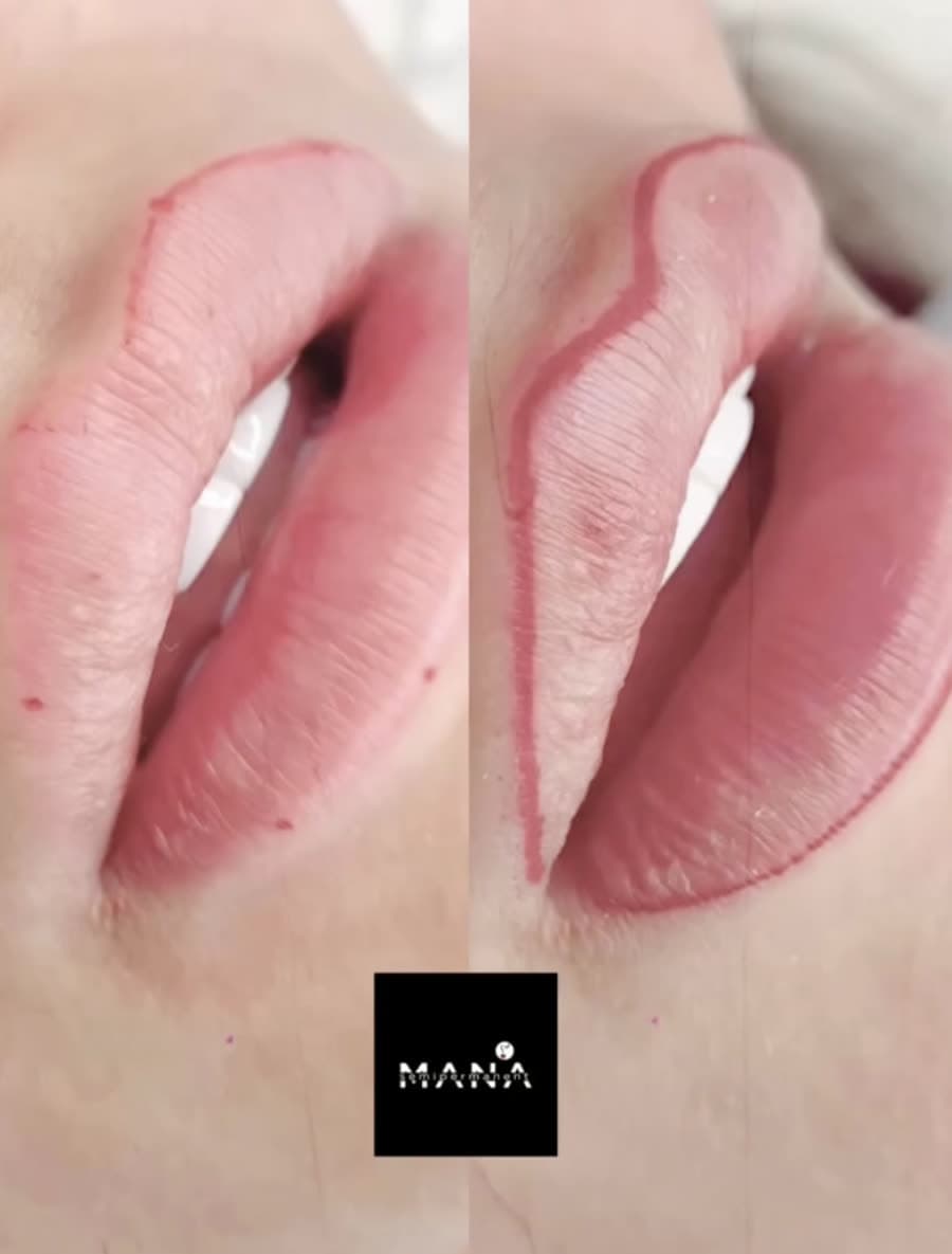 Lip Liner Shape Correction Precise lip liner reshaping natural lip symmetry, part of our lip treatments at Mana Semipermanent, Jesmond, Newcastle.